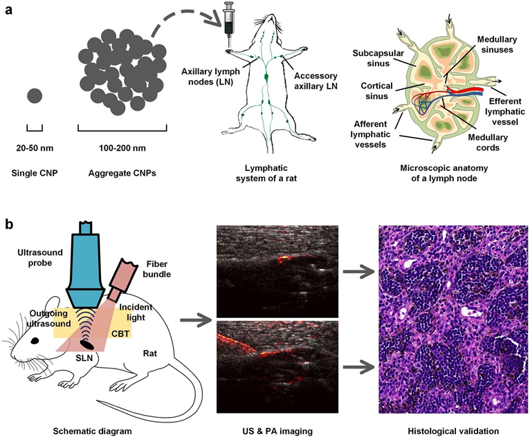 国内科大在生物医学光声成像方向取得研究进展 国内科大在生物医学光声成像方向取得研究进展