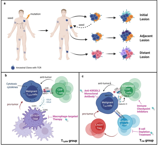光动力疗法治疗皮肤T细胞淋巴瘤 光动力疗法治疗皮肤T细胞淋巴瘤