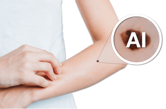 AI辅助皮肤癌筛查 AI辅助皮肤癌筛查