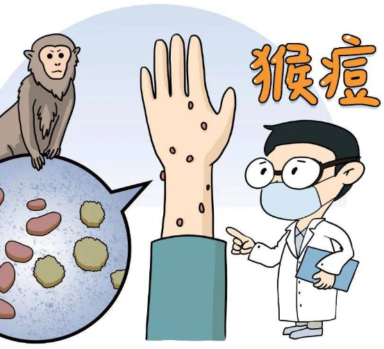 猴痘病毒 猴痘病毒