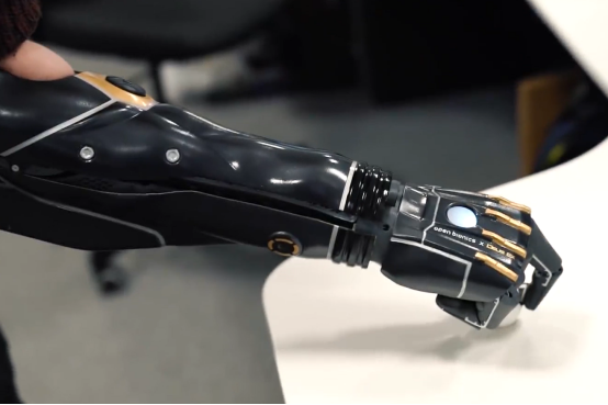 仿生神经接口技术为截肢者带来新希望 仿生神经接口技术为截肢者带来新希望