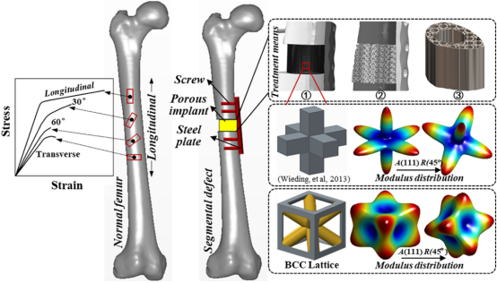 纳米骨支架 纳米骨支架