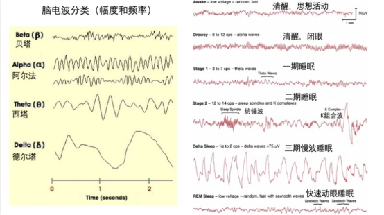 睡眠瘫痪症 睡眠瘫痪症