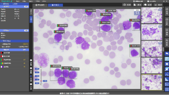 AI经血检测系统操作 AI经血检测系统操作