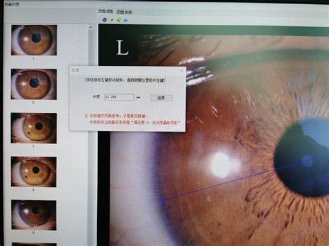 数字虹膜与生物虹膜的融合界面