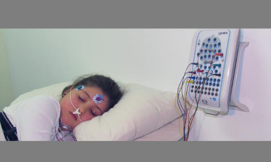 夜间监测模式下的脑电帽,显示睡眠期异常放电图谱 夜间监测模式下的脑电帽,显示睡眠期异常放电图谱