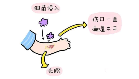 治疗12周后皮肤损伤基本消退
