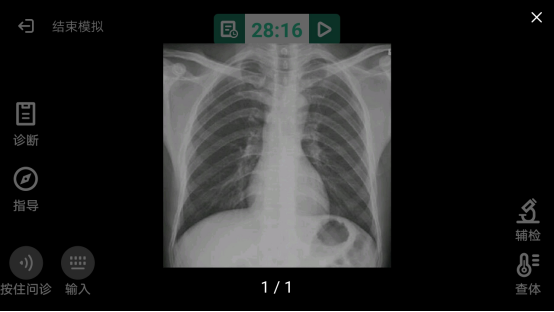 胸片与同款烟弹