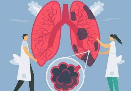 健康肺叶VS癌变肺叶