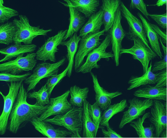 电子显微镜下瓣膜表面细胞