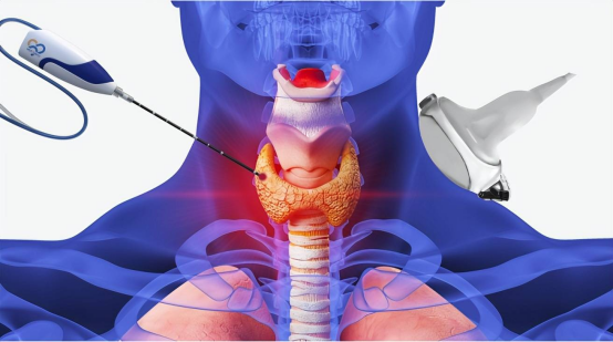 甲状腺诊疗利益链示意图