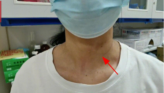 甲状腺结节处置流程图