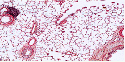 红色标记显示重金属颗粒嵌入肺泡上皮细胞核区域
