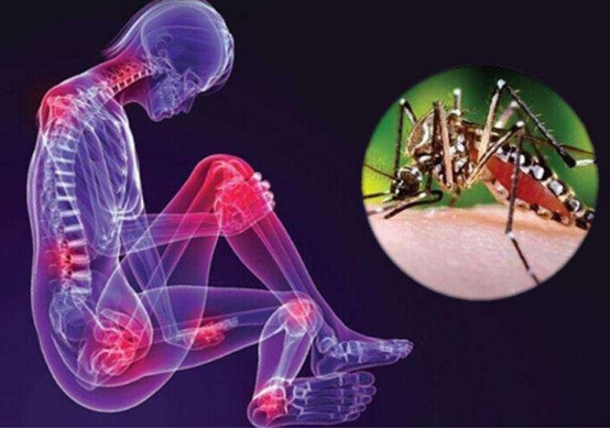 基孔肯雅热疫情、蚊媒传染病