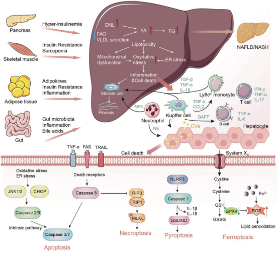 非酒精性脂肪肝治疗策略、精准医疗