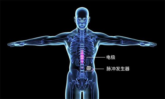 电刺激激活脊髓神经通路 电刺激激活脊髓神经通路