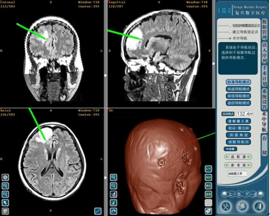 1744600711738626.png image.png