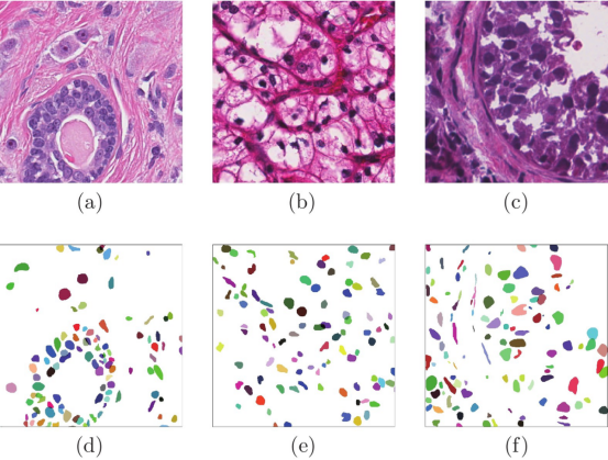 分屏对比正常细胞与改造细胞超微结构