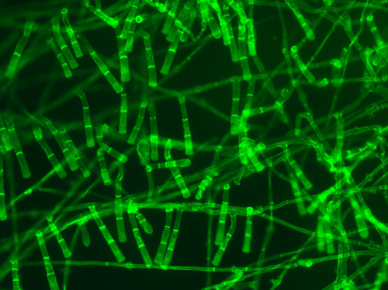 荧光显微镜下肠道古菌的独特结构