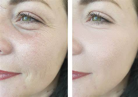 国际抗衰老疗法效果对比雷达图 国际抗衰老疗法效果对比雷达图