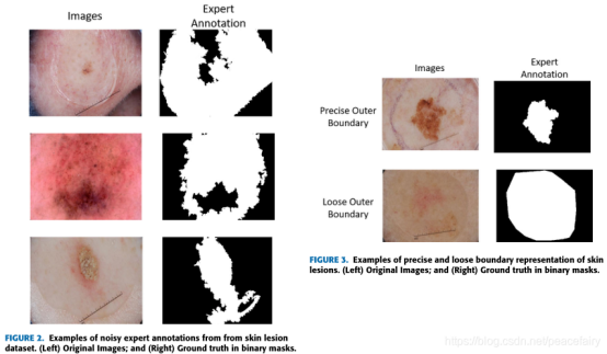 患者皮肤病变进程记录/健康皮肤与病变组织对比