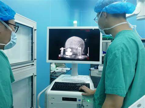 免疫吸附治疗仪工作状态/深部脑刺激手术