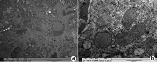 肝细胞线粒体电镜图对比 肝细胞线粒体电镜图对比