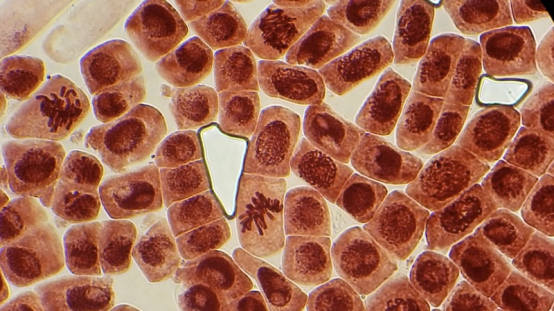 显微镜镜头中分裂的细胞与紧急停止标志重叠的抽象艺术图 显微镜镜头中分裂的细胞与紧急停止标志重叠的抽象艺术图