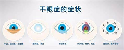 干眼症——现代社会的“隐形流行病” 干眼症——现代社会的“隐形流行病”