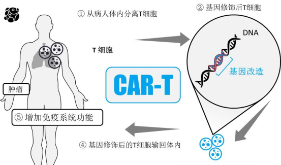 CAR-T如何成为复发防控的“守门员” CAR-T如何成为复发防控的“守门员”