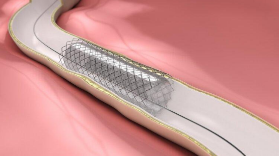 临床试验揭示革命性效果 临床试验揭示革命性效果