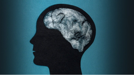 脑雾之谜:从困惑到突破 脑雾之谜:从困惑到突破