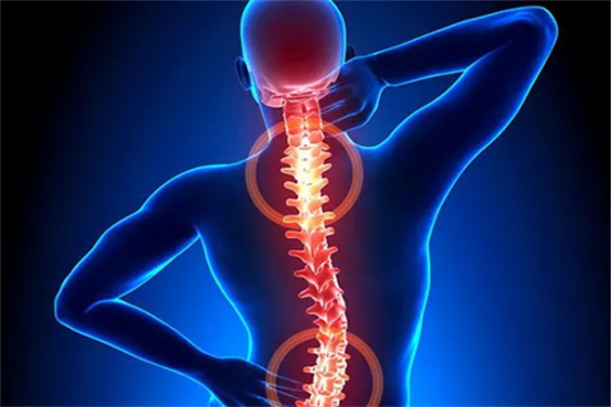 脊柱健康:一场关于未来的救赎 脊柱健康:一场关于未来的救赎