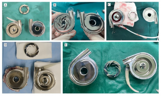 全磁悬浮双心室辅助系统的技术解析 全磁悬浮双心室辅助系统的技术解析