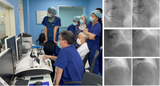 行业影响:改写血管介入治疗范式 行业影响:改写血管介入治疗范式