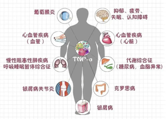 老年群体重症风险:多重机制叠加 老年群体重症风险:多重机制叠加