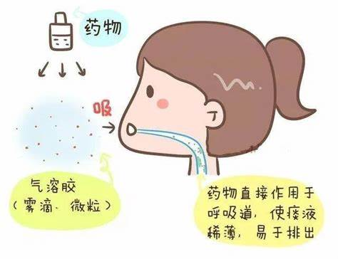 雾化治疗在哮喘管理中的核心地位 雾化治疗在哮喘管理中的核心地位