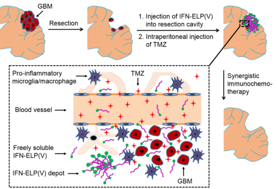 精准医疗在胶质母细胞瘤治疗中的优势与挑战 精准医疗在胶质母细胞瘤治疗中的优势与挑战