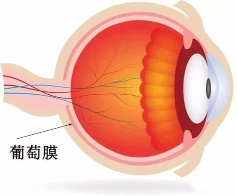 隐匿性后葡萄膜炎的特点与危害 隐匿性后葡萄膜炎的特点与危害
