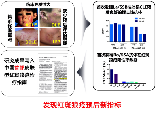 多学科诊疗:系统性红斑狼疮诊疗的新模式 多学科诊疗:系统性红斑狼疮诊疗的新模式