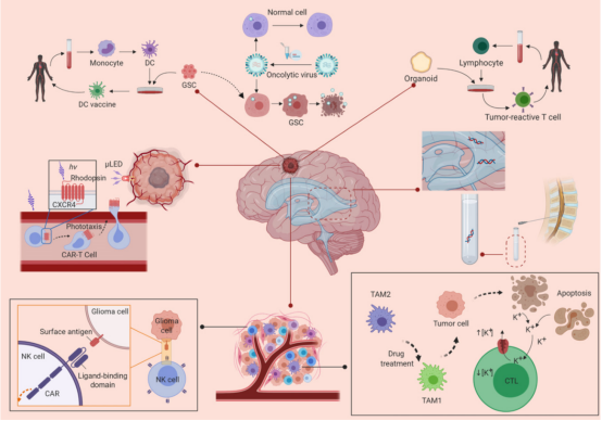 胶质瘤:高恶性度的“绝症”挑战 胶质瘤:高恶性度的“绝症”挑战