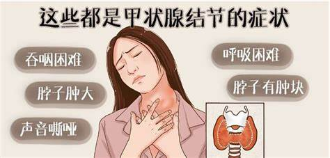 甲状腺结节的成因与风险因素 甲状腺结节的成因与风险因素