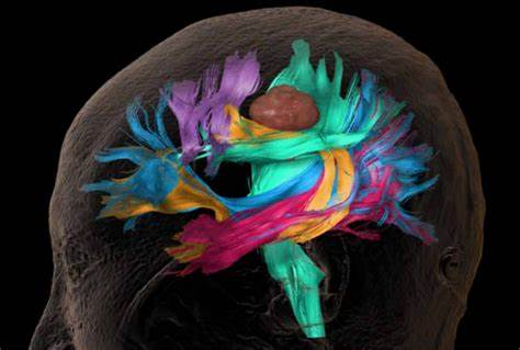 多模态影像融合:穿透组织的“透视眼” 多模态影像融合:穿透组织的“透视眼”