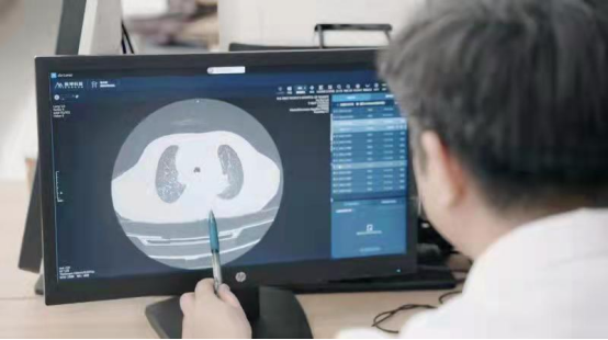 基层诊疗效率提升的实证效果 基层诊疗效率提升的实证效果