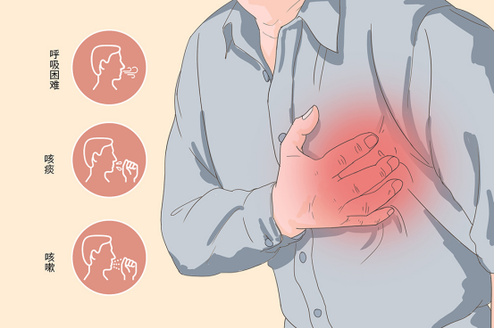 心衰与瘫痪的生死博弈 心衰与瘫痪的生死博弈