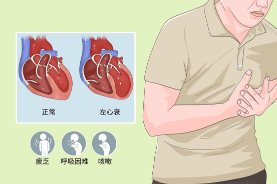 脑机接口与人工心脏的协同创新 脑机接口与人工心脏的协同创新
