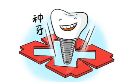 种植牙集采政策内容 种植牙集采政策内容