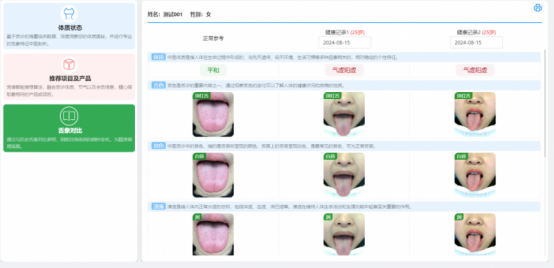 AI舌诊仪的应用现状与发展前景 AI舌诊仪的应用现状与发展前景