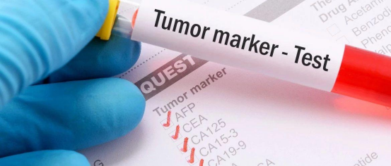 肿瘤标志物检测纳入常规体检的实践路径 肿瘤标志物检测纳入常规体检的实践路径