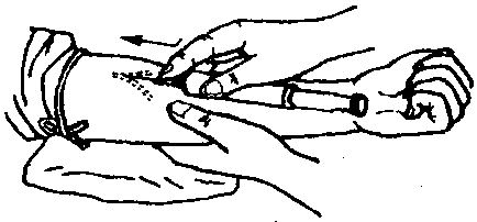 医学突破:从60小时静脉注射到14天口服 医学突破:从60小时静脉注射到14天口服